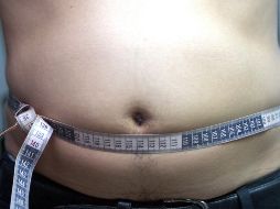 De acuerdo al estudio, la obesidad mórbida en adultos jóvenes 