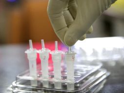 Actualmente, existen aún tres mil 520 casos activos en Jalisco. EFE/P. Adhikary