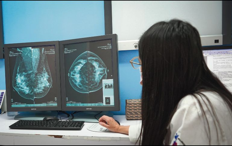 MASTÓGRAFO DIGITAL. La Secretaría de Salud Jalisco informó de la  inversión de casi tres millones de pesos en un aparato que duplicará la atención. ESPECIAL