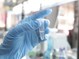 Un total de diez vacunas europeas, estadounidenses, chinas y rusas están siendo probadas actualmente a gran escala en todo el mundo. EFE/ARCHIVO