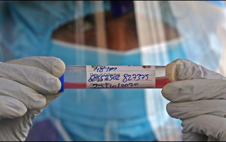 La universidad Johns Hopkins contabiliza mil 021 muertes en las últimas 24 horas. EFE/ARCHIVO