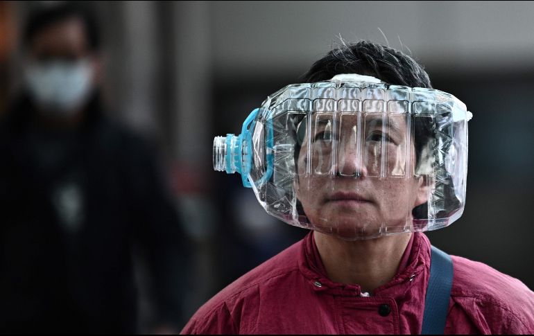 Seis meses después del comienzo de los síntomas, cerca de la mitad de los pacientes presentaban al menos un patrón no normal en las tomografías computerizadas. AFP / A. Wallace