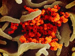 Todavía se desconoce hasta qué punto el incremento de contagios en todas las franjas de edad se debe a la nueva cepa del coronavirus. AP/NIH/ARCHIVO