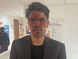 César subrayó que no hubo motivo específico para que lo golpearan. FACEBOOK / César D´Alessio