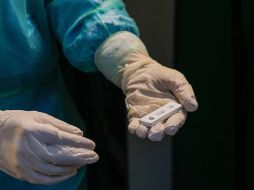 La variante afecta a un mayor número de pacientes más jóvenes, sin comorbilidades, que desarrollan formas graves de la enfermedad. EFE/T. Romano