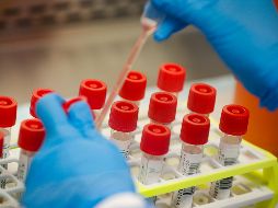 En Jalisco, cuatro de cada 10 pruebas PCR para detectar COVID-19 se pagaron en laboratorios particulares. EL INFORMADOR/ARCHIVO