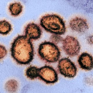 COVID-19: Variante detectada en Jalisco podría ser mexicana