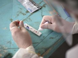 La investigación sobre la nueva variante se hizo con 31 muestras de pacientes con covid-19 en la capital de Amazonas. GETTY IMAGES