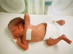 El bebé prematuro nació el  jueves pasado en un hospital privado de Tecámac, Estado de México, con el apoyo de autoridades municipales . EL INFORMADOR/ARCHIVO