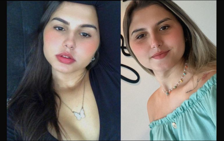 Mayla Rezende (i) y Sofia Albuquerck (d) luego de la cirugía en Blumenau, Brasil.  AFP/ESPECIAL/MAYLA REZENDE/SOFIA ALBUQUERCK