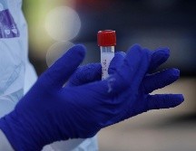 El kit de diagnóstico COVIFLU permitirá reforzar la estrategia de vigilancia epidemiológica del sistema de RADAR Jalisco y reducir costos. AP / ARCHIVO