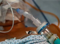 Se sospecha que el compañero de habitación en el hospital de la víctima de 76 años desconectó los equipos que mantenían con respiración al hombre porque el ruido de éstas lo molestaba. AFP / ARCHIVO