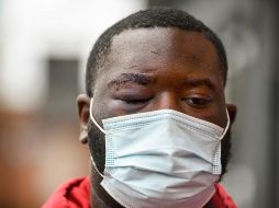 Se hizo público el video de la pelea de Aaron Donald, tackle defensivo de los Rams de Los Ángeles. AP / S. Mellon