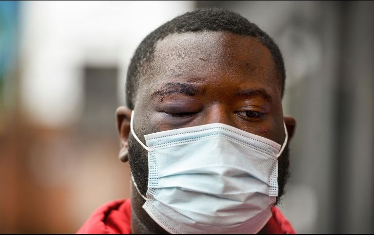 Se hizo público el video de la pelea de Aaron Donald, tackle defensivo de los Rams de Los Ángeles. AP / S. Mellon