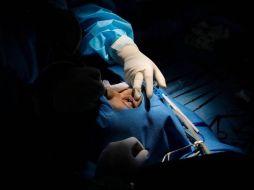 La enfermedad ha sido asociada recientemente al COVID-19. EFE