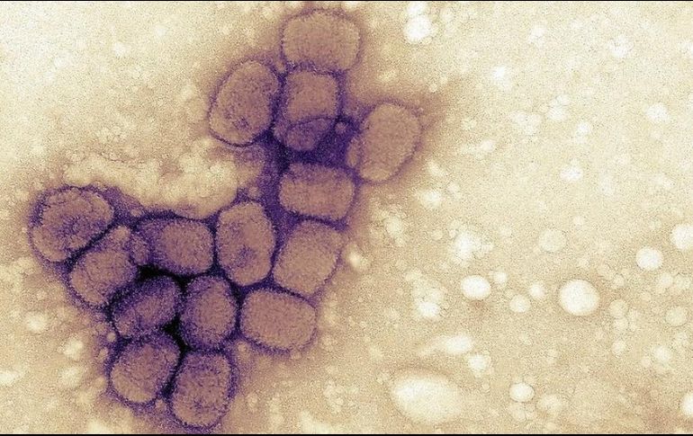 La enfermedad fue erradicada en 1980. GETTY IMAGES