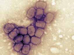 La enfermedad fue erradicada en 1980. GETTY IMAGES