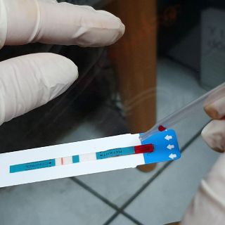 COVID-19 tuvo "devastador" impacto mundial en lucha contra sida, tuberculosis y paludismo