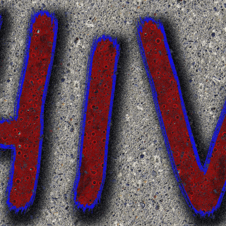 El  tratamiento global del VIH y la tuberculosis cae debido a la pandemia