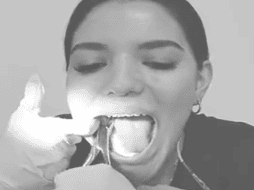 La mujer, identificada como Ana Victoria en su cuenta de Twitter, compartió el video a través de dicha plataforma en el que se le puede ver aplicarse la anestesia con una jeringa, gracias a la ayuda de un espejo. ESPECIAL / TWITTER