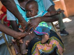 Aunque es la primera vacuna en ser autorizada, es solamente 30% efectiva y requiere hasta cuatro dosis y su protección se disipa luego de apenas meses. AP / ARCHIVO