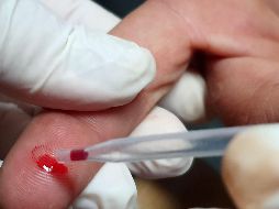 Indican que las personas con VIH en Jalisco tardan hasta seis meses para recibir una cita médica e iniciar su tratamiento. EL INFORMADOR/ARCHIVO