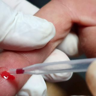 Denuncian falta de atención a personas con VIH por parte del sistema de Salud Jalisco