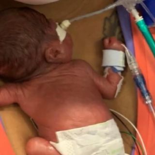 ¡Increíble! Niño de Alabama obtiene récord de bebé más prematuro