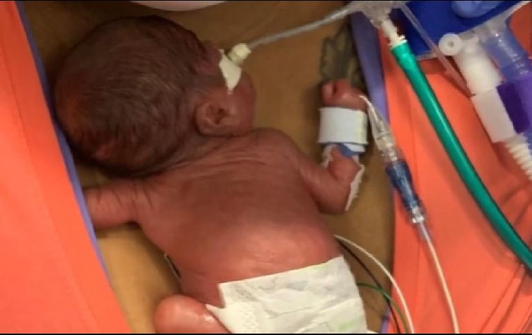 Curtis Means tiene el Récord Guinness del bebé más prematuro del mundo con 420 gramos al nacer. ESPECIAL
