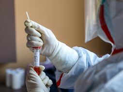 La OMS estima que una parte importante de los casos menos graves o asintomáticos en el mundo siguen sin detectarse, pese a que los avances en la medicina son cada vez mayores para el rastreo. AFP / ARCHIVO