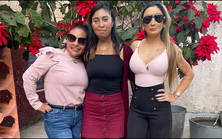 Mujeres sobrevivientes a ataques con ácido. CORTESÍA/P. PERÓN