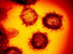 Ómicron, que presenta un elevado número de mutaciones y una resistencia importante a las vacunas, fue identificado por primera vez en Botsuana y Sudáfrica a finales de noviembre. AP/NIH/ARCHIVO