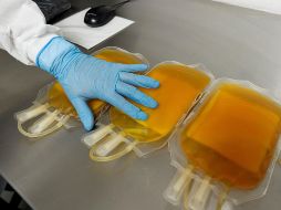 Concluyen que la transfusión del plasma de convalecientes es un tratamiento muy costoso y difícil de administrar. EFE/ARCHIVO
