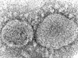 La semana del 26 de noviembre al 2 de diciembre, Florida registró 10 mil 892 nuevos casos de COVID-19. AP/H. Bullock