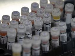 Las pruebas para la creación de la vacuna contra el VIH son muy prometedoras.  EFE/ ARCHIVO