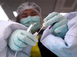 El estudio analizó el plasma de 15 personas previamente vacunadas y no vacunadas que pasaron la COVID-19 durante la gran ola de infecciones en Sudáfrica con el surgimiento de ómicron. EFE / D. Azubel