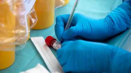 Con 30 mil 671 nuevos casos de COVID-19 registrados ayer sábado, México rompió el máximo de contagios en un día. AP / ARCHIVO