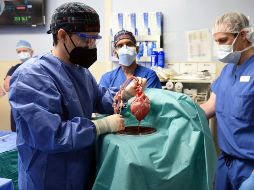 Comprueban que un corazón animal modificado genéticamente puede funcionar como un corazón humano sin un rechazo inmediato por parte del cuerpo. AP/University of Maryland School-M. Teske