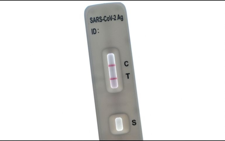 En muchas regiones, se ha reportado escasez de este tipo de test, lo que ha dificultado contener la nueva ola de contagios. AFP / ARCHIVO