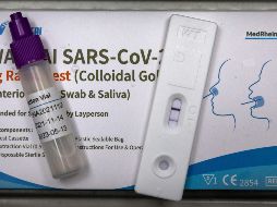 Estas pruebas se venden a través de Internet y en varios comercios sin licencia. AFP/O. Andersen