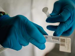 La incubación de la variante de ómicron ocurre en alrededor de tres días. EL INFORMADOR / G. Gallo