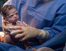 Esta imagen del nacimiento de Isabela Bravinha rápidamente se volvió viral en 2020. INSTAGRAM: @rodrigokunstmann