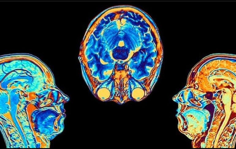 Los cambios se registraron en las zonas vinculadas al olfato y la memoria. UK BIOBANK