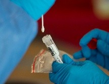 A la fecha no hay tratamiento específico para los efectos de la neblina postCOVID. AFP / ARCHIVO