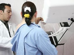 La calcificación arterial mamaria es una acumulación de calcio en la capa media de la pared arterial de la mama. EL INFORMADOR/ARCHIVO