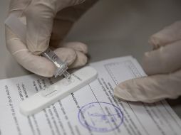 Las diferencias entre la ómicron y la delta son especialmente relevantes en los pacientes de mayor edad. XINHUA/W. Tiancong