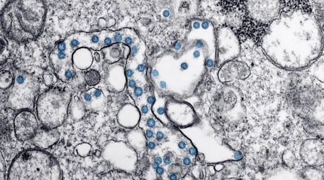 Creen que es probable que la variante Deltacron se propague, sin embargo, ómicron sigue extendiéndose ampliamente en continentes como Europa. AFP / ARCHIVO