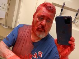 Las imágenes de la agresión con pintura al periodista fueron publicadas por el medio. ESPECIAL