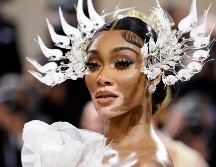 Winnie Harlow. AP/Evan Agostini