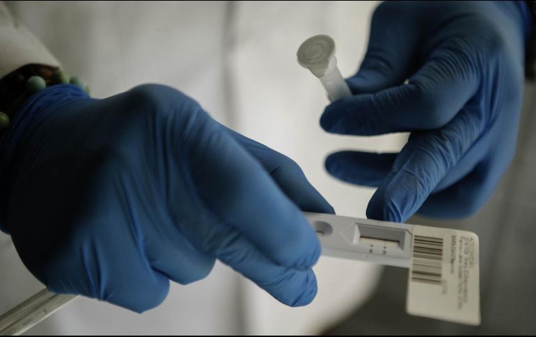 Primer caso del virus viruela en Inglaterra. INFORMADOR/ ARCHIVO